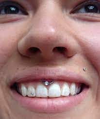Lippenbaendchen Lippenbandchen Smileypiercing Piercing Janeabsinth Livingillustrations Dusseldorf Tat Smiley Piercing Piercings Ear Conch Ear Piercings