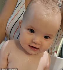 Worst disease outbreak in 20 years strikes Australia