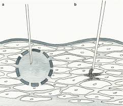 The experiments presented in this paper support the idea that the output of small lymphocytes from the thoracic duct of the rat… expand. The Revised Starling Principle And Its Relevance To Perioperative Fluid Management Springerlink