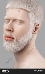5 reasons why your hair may turn white or gray at a young age. Portrait Young Albino Image Photo Free Trial Bigstock