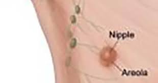 The main symptom of gynecomastia is enlarged breasts. Nih Study Confirms Risk Factors For Male Breast Cancer National Cancer Institute