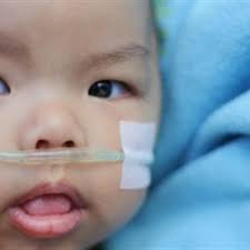 But, when there is the contaminants that could stimulate the cancer like smoke, the cells will begin to grow abnormally. Pulmonary Hypertension In Infants Children Healthychildren Org