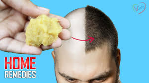 Scalp massage and hot oil treatment massaging your scalp helps improve circulation and hence stimulates hair growth, and you only need to do it for about five minutes daily to see results. 10 Powerful Home Remedies For Hair Loss Hair Growth Youtube