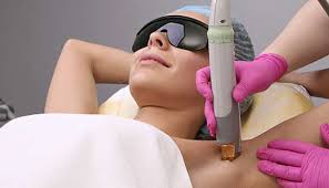 Laser hair removal armpits how many sessions. Hair Removal Cutera