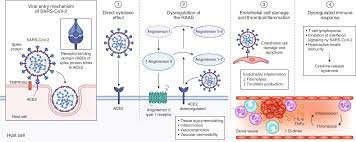 Maybe you would like to learn more about one of these? Extrapulmonary Manifestations Of Covid 19 Nature Medicine