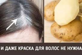 как осветлить волосы в домашних условиях без вреда для волос Vot Kak Mozhno Privlech Udachu Dengi I Lyubov S Pomoshyu Obychnoj Bulavki Rabotaet Interesno Win Sedye Volosy Lekarstva Dlya Volos Maski Dlya Volos