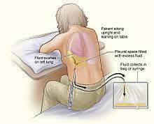 They're shock absorbers, decreasing stress on the pelvis. Pleurisy Wikipedia