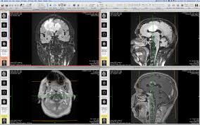 Ginkgo cadx is a free open source dicom viewer software for windows, linux, and macos. Dicom Viewer Osirix Labiopro