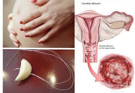 3 Natural Ways To Get Rid Of A Yeast Infection Even If You Re Pregnant Yeast Infection Treatment Yeast Infection Causes Yeast Infection Relief