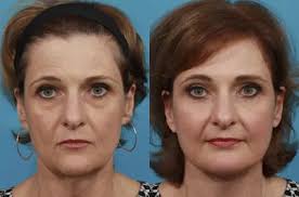 SALVATORE “SAM” LAZZARA