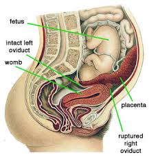 All of the products meet my pregnancy safe criteria. When A Fetus Turns To Stone Psychology Today