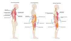 It is rare to find a person who does not have tightness in these muscles, especially the hams. Back And Hips