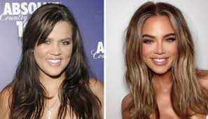 Khloe kardashian is finally setting the record straight after years of speculation that she had plastic surgery procedures the reality sta. Khloe Kardashian S Entire New Face Leaves Fans Freaked Out Amid Claims Of Drastic Plastic Surgery Newshub