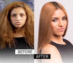 DESIGN ESSENTIALS STS TREATMENT