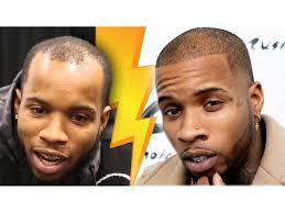 Comment below who you wanna. Tory Lanez Hair Transplant Hair Analysis By Matt Dominance