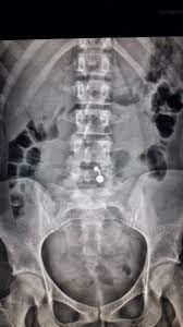 Pin On X Rays