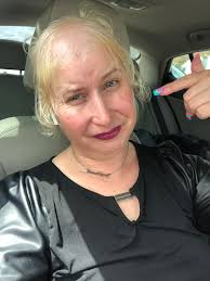 What causes facial swelling?