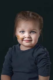 Bijzondere fotoserie van kinderen met hulpmiddelen: 'In het zwembad zaten  ze haar aan te gapen ...'