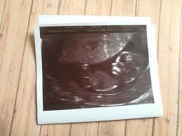 Ecografia De 12 Semanas Como Es Se Vera El Sexo Del Bebe Fin Del Primer Trimestre Del Embarazo Disfruti