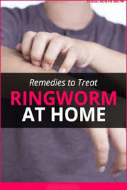Does hand sanitizer kill the ebola virus? 10 Home Remedies For Ringworm Skin Ideas Home Remedies For Ringworm Ringworm Ringworm Remedies