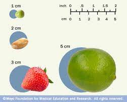 Should you wish to convert from inches to centimeters you can multiply by 2.54. Tumor Size Mayo Clinic