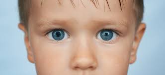 Is Anisocoria Serious Horners Syndrome Lawsuits Birth Injury Lawyers Group