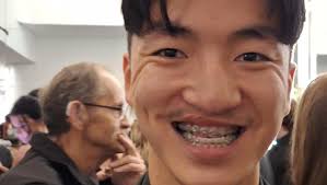 Fundraiser by Leanne Franson : Benn's Lifechanging Cleft Jaw Surgery for  Underbite