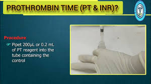 Image result for Prothrombin Time
