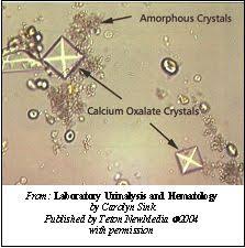 Crystals And Amorphous Sediment In Urine Medical Lab Technician Medical Laboratory Technician Medical Laboratory Science