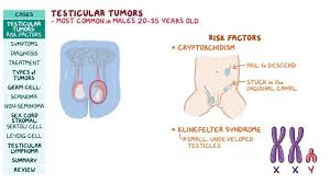But testicular cancer is the most common cancer in american males between the ages of 15 and 35. Testicular Tumors Pathology Review Osmosis