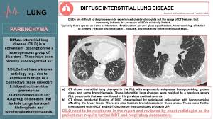 Scroll using the mouse through the right lung. Epos Trade