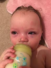 Shame this cat for vomiting