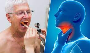 Tobacco smoking is by far the most. Cancer Symptoms Sore Throat Is A Sign Of This Uncommon Disease Express Co Uk