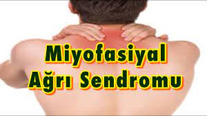 Miyofasiyal ağrı sendromuna ve fibromiyalji sendromunu karşılaştıracak olursak; Miyofasiyal Agri Sendromu Nedir Mas Youtube