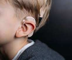 Image result for Cochlear Implant