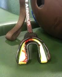 14 years ago!! #rollerderby