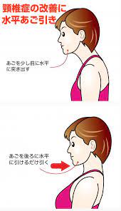首が痛い 手がしびれる 頸椎症 は再発しやすい 根治をめざすなら 水平あご引き で首筋を強化 カラダネ 首の痛み 首 セルフケア