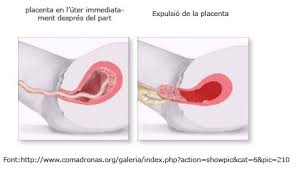 Resultat d'imatges de el part