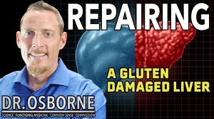 As of 2010, scientific evidence that might bolster this association remains scarce. Does Gluten Cause Liver Damage Part 2 With Dr Osborne Gluten Free Society