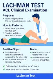 Image result for Lachman Test