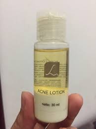On july 5 2021, a facebook account shared a post warning people about ogx brand shampoo and dmdm hydantoin, writing: Larissa Acne Lotion Kesehatan Kecantikan Kulit Sabun Tubuh Di Carousell
