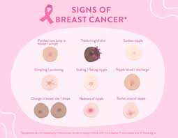 A dimple on the breast does not always mean breast cancer but if it is a new finding, it should be investigated as the formation of a tumor can sometimes pull the skin into the breast causing the dimple. It Could Happen To You Early Signs Of Breast Cancer And How To Do A Breast Self Examination Nestia