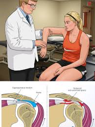 Image result for Hawkins Test