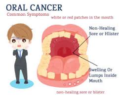 Cdc research parents want to know that hpv vaccine is effective. Oral Cancer Posts And Articles From Lowcountry Family Dentistry