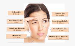 You can easily determine whether a celebrity has botox or not. Should You Try Botox Injections For Wrinkles Can I Get Botox On My Face Hd Png Download Kindpng