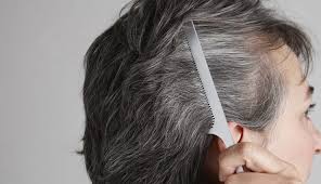 Clairol shimmer lights shampoo is the perfect choice in this regard. 5 Home Remedies To Treat Grey Hair Lifeberrys Com