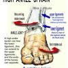 In this pictorial essay, the ligaments around the ankle are grouped, depending on their anatomic orientation, and each of the ankle ligaments is discussed in detail. 1
