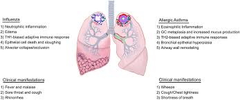 History of tobacco dependence (z87.891) (per chapter 10). Frontiers Influenza In Asthmatics For Better Or For Worse Immunology