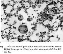 O vírus sincicial respiratório (vsr) é uma causa muito comum de infecções das vias aéreas, especialmente em crianças. Scielo Brasil Infeccao Natural Pelo Virus Sincicial Respiratorio Bovino Brsv No Estado De Alagoas Infeccao Natural Pelo Virus Sincicial Respiratorio Bovino Brsv No Estado De Alagoas