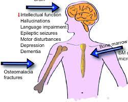 Principal Targets Of Aluminium Toxicity In Humans Download Scientific Diagram